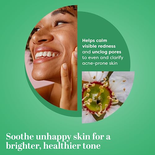 TruSkin Tea Tree Oil Acne Treatment for Face – Acne Serum – Improve the Appearance of Pores, Skin Tone for Smooth, Glowing Skin with Salicylic Acid, Vitamin C, Niacinamide & Retinol, 2 OZ