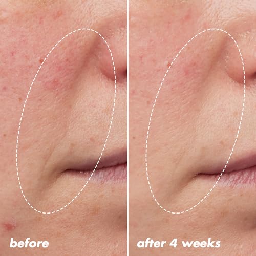 e.l.f. SKIN Youth Boosting Blue-ty Sleep Night Oil, Gentle Overnight Face Oil, Treats Fine Lines & Uneven Texture, Lightweight, Vegan & Cruelty-Free