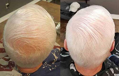 Zenagen Revolve Thickening and Hair Loss Shampoo Treatment for Men, 6 oz.