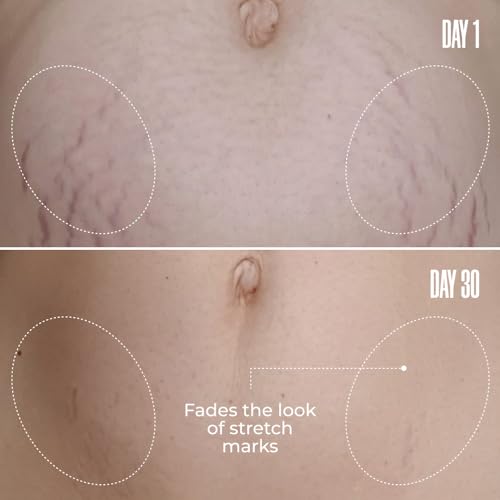 MAËLYS Cosmetics B-FLAT Belly Firming Cream - Stretch Mark Belly Cream - Tightening Belly Cream