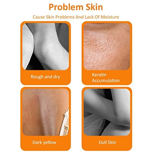 2PCS Orange Peeling Lotion, Body Peeling Lotion, Instant Exfoliation Dead Skin Remover Peeling Gel for Skin Body Face Neck Knees Foot