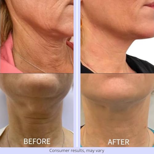 Doubao Neck Firming Cream, Moisturizer Face Cream for women, Anti-Aging Neck Creams for Tightening Lifting Sagging Skin and Hydrating