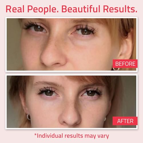 YEOUTH Retinol Eye Cream Anti Aging, Firming Under Eye Cream for Puffiness and Bags Under Eyes for Wrinkles and Dark Circles with Hyaluronic Acid and Tripeptides 15ml