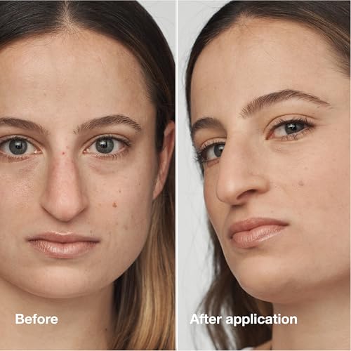 Clinique Even Better Clinical Serum Full Coverage Hydrating Foundation Broad Spectrum SPF 25 With Vitamin C, Salicylic Acid + Hyaluronic Acid For Oily Skin Types, Cream Chamois, 1 Fl Oz