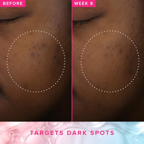 Farmacy 3% TXA Toner for Face - Brightening Face Toner for Oily Skin - Liquid Exfoliant with Azelaic Acid + 5% PHA to Target Visible Dullness + Help Reduce Uneven Skin Tone (10ml)