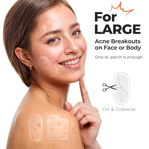 TKTK Large Pimple Patches for Face, 60 x 30 mm XL Acne Patches, Big Hydrocolloid Bandages for Body, Back, Forehead, Chin, Neck Blemish Zit Breakouts (Oval, Square, Dot 5 Sizes 124 Count)
