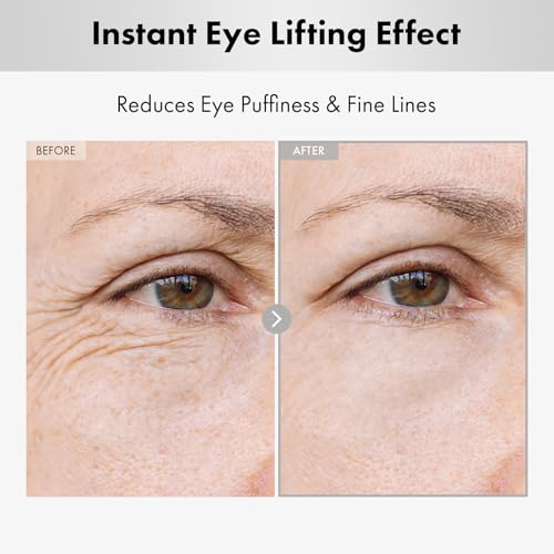 NATUREKIND Hyaluron Lifting Eye Cream, Hyaluronic Acid, 5% arbutin, Niacinamide for Puffy Eyes, Dark Spot and Fine Lines, Hydrating Under Eye Bag, Korean Skin Care, 15ml, 0.5 fl. oz.