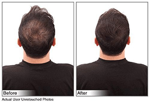 Juveker Hair Building Fibers for Men & Women - 28 Grams (Net Wt .98oz) Dark Brown AD