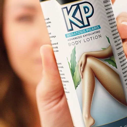GOLDEN NUTRITION Smoothing & Hydrating KP Lotion, Exfoliating Moisturizer for Rough, Bumpy Skin, AHA & BHA Formula for Keratosis Pilaris 6.76 fl oz