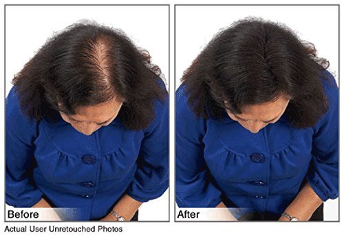 Juveker Hair Building Fibers for Men & Women - 28 Grams (Net Wt .98oz) Dark Brown AD