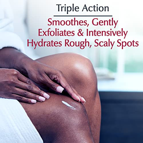 Eucerin Roughness Relief Spot Treatment, Urea Enriched Body Moisturizer for Dry Skin, Rough and Scaly Spots, With Precision Tip for Targeted Application, 2.7 Oz Tube