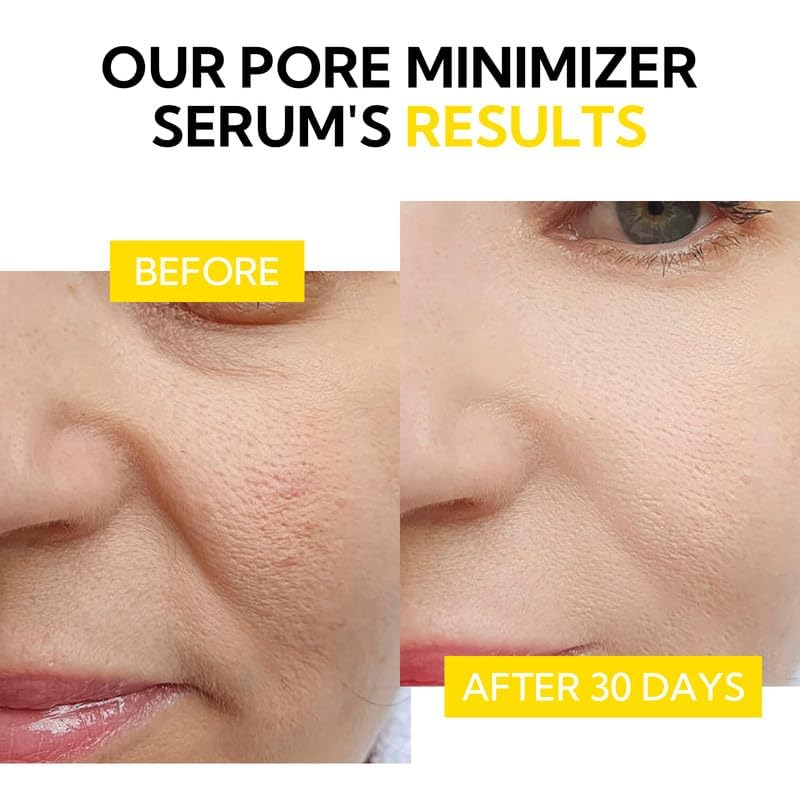 LANBENA Pore Minimizer Serum, Pore Minimizer & Reducer for Face, Minimizing, Shrinking, Oil Control Firming, Tightening Pores, 100% Vegan Pore Moisture after Blackhead Remover, 0.5 fl.oz