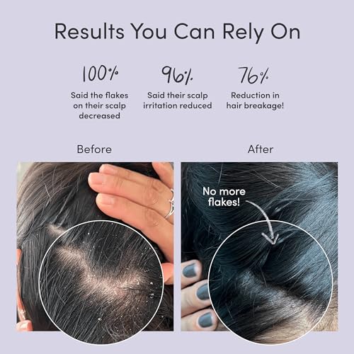 Jupiter, Physician-Formulated Anti-Dandruff Shampoo & Conditioner, for Flaky, Itchy, Oily, Dry Scalp, Vegan, Sulfate-Free, Color-Safe, & Paraben-Free, Dry Scalp Shampoo and Conditioner for Women & Men