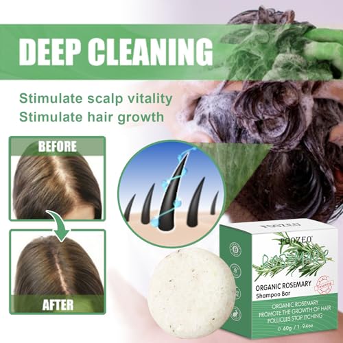 2 Pack Rosemary Hair Shampoo Bar,Deep Cleansing for Scalp Hair Loss Shampoo Soap,Organic Shampoo Oil Control,Solid Shampoo Bar for Hair Growth, Refreshing and Hydrating Bar for Mothers Day Gifts