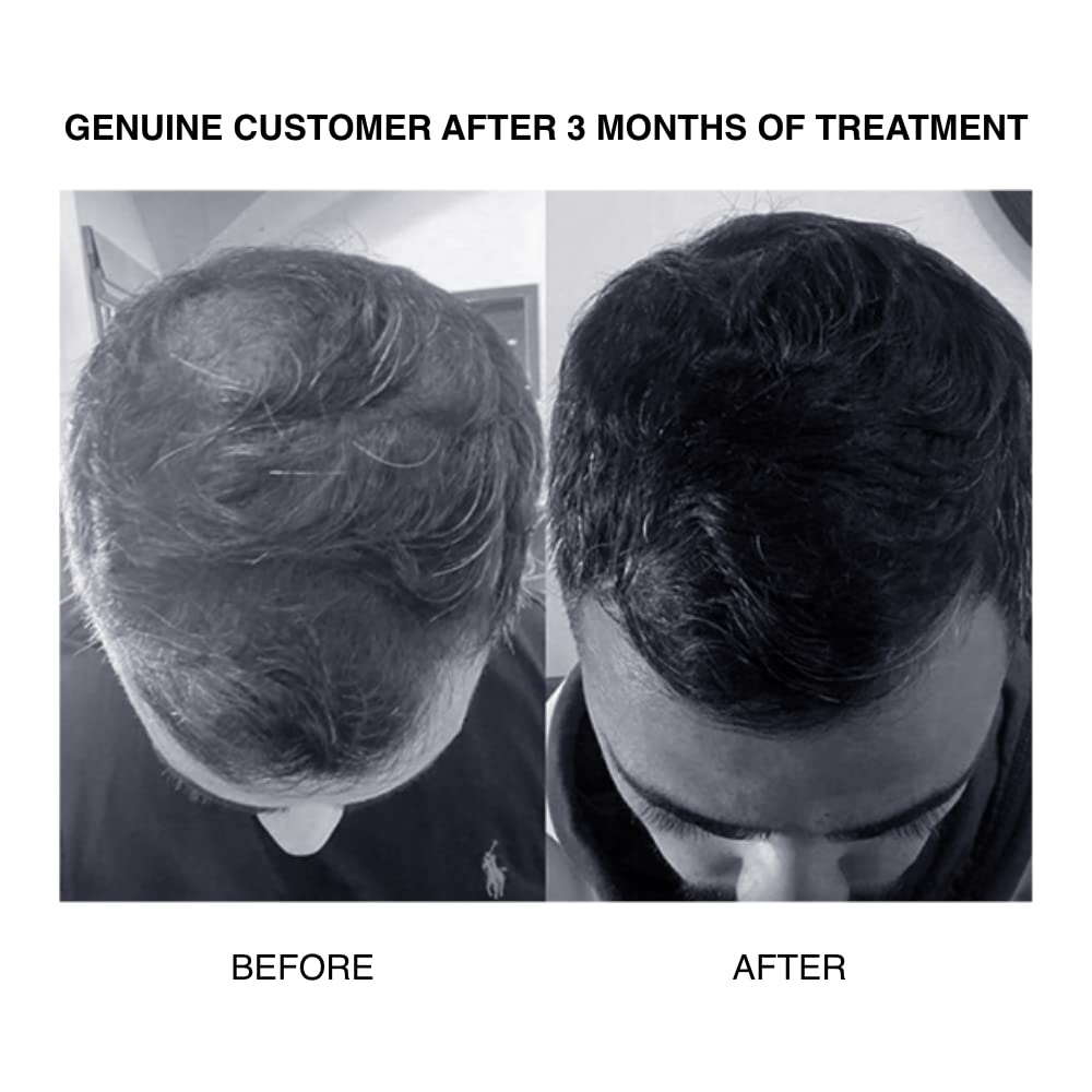 PATRICKS | CD PLUS Daily Conditioner | DHT Blocking Ultra Thickening Conditioner | Notes of Neroli, Bitter Orange | High Performance Grooming for Men | Thickens Hair & Stimulates Scalp | 200mL