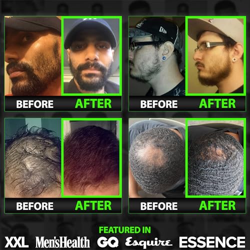 GROW Hair & Beard 11-in-1 Wash: Shampoo, Conditioner Softener, Biotin, Castor Oil, Peppermint Essential Oil, Vitamin E, MSM, Keratin, Algae, LCLT - Supports Healthy Growth - Vegan - BBS USA Product