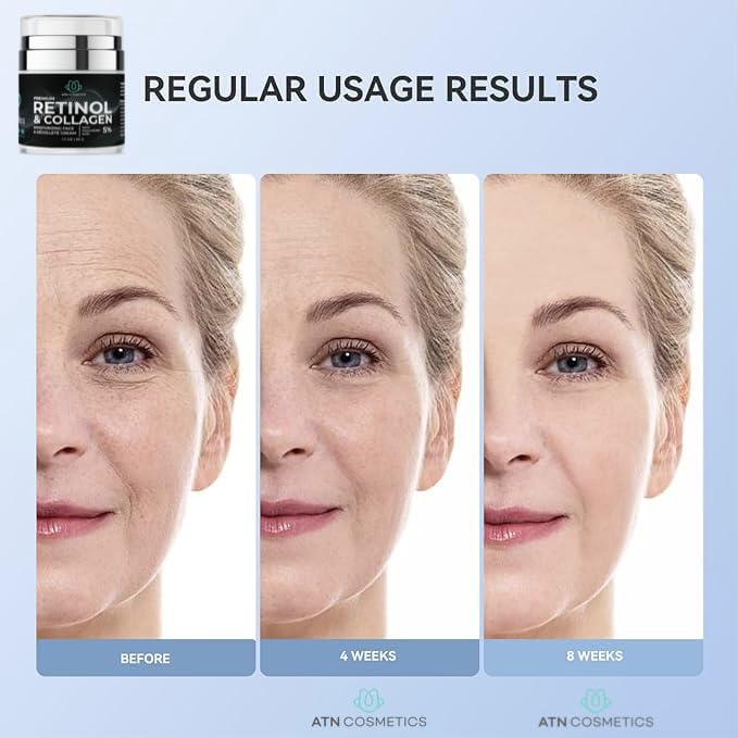 ATN Cosmetics Retinol Cream for Face & Neck, Collagen Moisturizer, Day & Night Cream for Women & Men, Anti Aging, Wrinkle Cream with Hyaluronic Acid, Made in USA