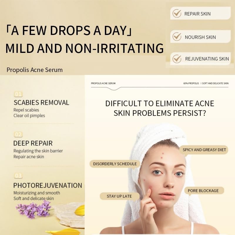 60% Propolis Moisturizing Face Serum - Nicotinamide Serum - Korean Serum Serum to Balance Oil, Moisturize And Smooth Skin