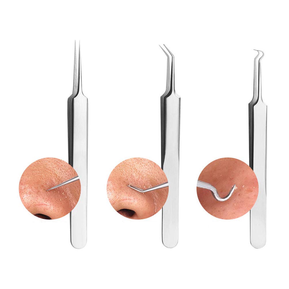 8 Pcs Stainless Steel Blackhead Remover Comedone Pimple Extractor Tool Kit with Metal Case for Pimples, Blackheads, Zit Removing for Face Nose