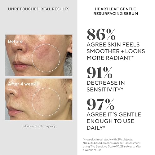 Murad Heartleaf Gentle Resurfacing Serum for Sensitive Skin - Microdosed Glycolid Acid and AHA to Polish and Resurface Skin to Improve Radiance and Smooth Fine Lines - 1.0 Fl Oz