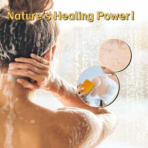 Uselective Kojic Acid & Turmeric Soap Bar for Dark Spot removal - Skin Lightening Soap with Vitamin C, Retinol, Shea Butter & Lemon Oil - for Face, Body, Underarms - SLS Free, for Oily & Dry Skin