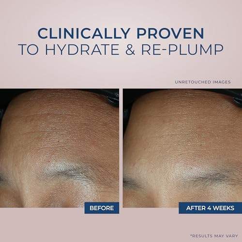 RoC Retinol Correxion Max Daily Hydration Anti-Aging Face Moisturizer with Hyaluronic Acid for Fine Lines, Dark Spots, Post-Acne Scars, Oil Free, Stocking Stuffers, 1.7 Ounces (Packaging May Vary)