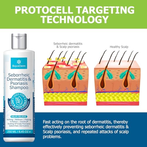 Roycederm Psoriasis Shampoo, Seborrheic Dermatitis Shampoo, Folliculitis Shampoo, Dandruff Shampoo, Scalp Psoriasis & Seborrheic Dermatitis Treatment, Dry Itchy Scalp Treatment