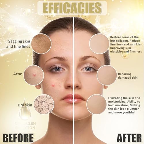 YMEYFAN Jelly Mask Powder for Facials Professional - Collagen Firming & Moisturize Face Mask Skin Care, Anti-Aging Jelly Mask, Peel Off Jelly Masks for Spa, 17.6 Fl Oz