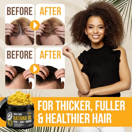 Vie Naturelle 100% Pure Batana Oil for Hair Growth from Honduras – Organic Raw Unrefined – Natural Moisturizer for Skin & Hair – Traditionally Cold-Pressed from Honduran Palm Nut