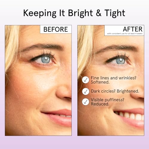 grace & stella Under Eye Cream Anti Aging - Brigthening Cream with Retinol & Caffeine - Reduce Dark Circles, Wrinkles, Puffiness - with Niacinamide, Peptides - Vegan Skincare - Free(0.5 fl.oz / 15ml)