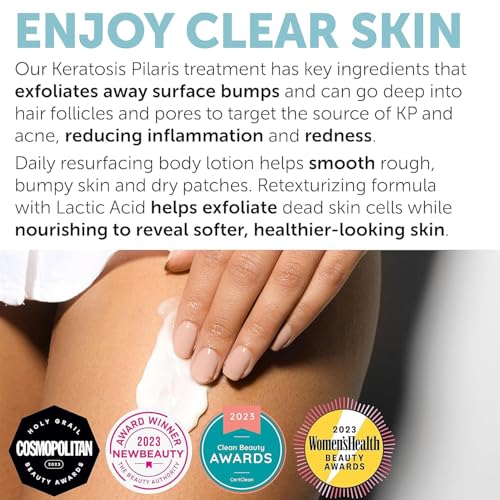 Keratosis Pilaris Treatment | Keratosis Pilaris Lotion | KP Lotion | Gentle Exfoliation For Strawberry Legs, KP & Ingrown Hairs | Smooth & Hydrating Body Lotion For Redness, Dry, Rough And Flaky Skin