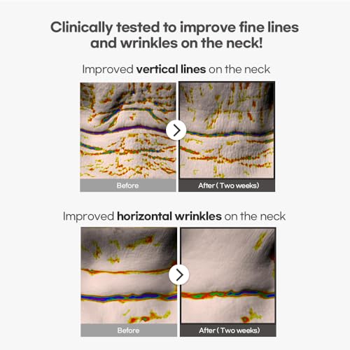 Avajar Rejuvenating Neck Wrinkle Control Mask – Advanced Wrinkle Patches with Collagen and PDRN, Anti-Aging Tightening Mask for Smoother, Firmer Skin (5-Pack)