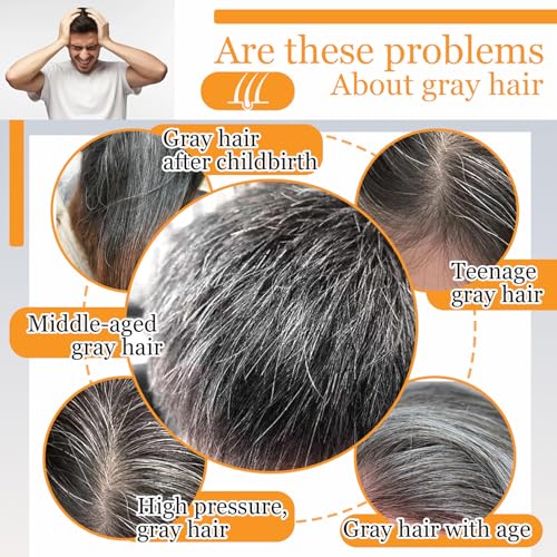 2PCS Black Shampoo Bar Soap,Moisturizing Gray Hair Reverse Soap Bar,Natural Hair Darkening Grey Hair Coverage Shampoo Bar Soap for Men & Women