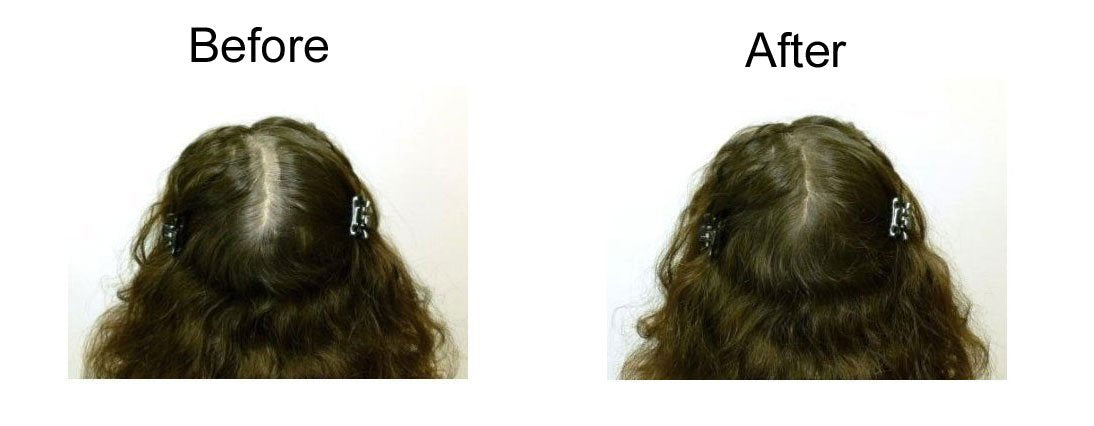 My Secret Correctives Root Touch-Up Spray 2 oz - Medium...