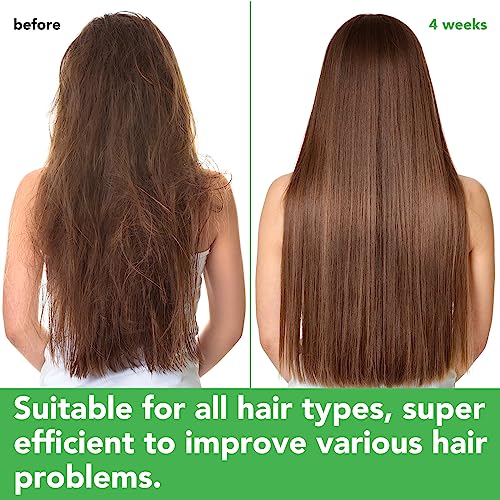 Rosemary Mint Shampoo and Conditioner set Infused with Biotin Promotes Hair Growth & Scalp Health, Strengthen Weak and Brittle Hair for All Hair Types