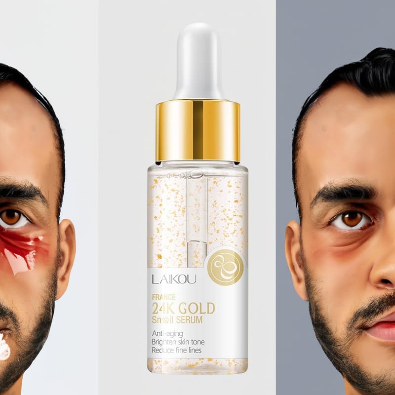 EKHAYA Snail Mucin Repair Serum: Hydrating Snail Mucin Essence Serum with Vitamin C for Skin Rejuvenation, Dark Spot Reduction, and Fine Line Smoothing