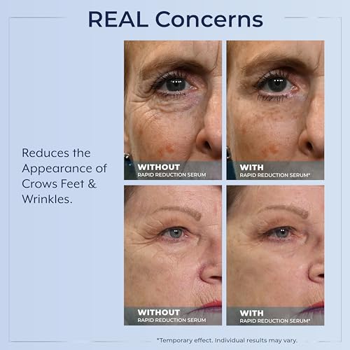 Plexaderm Rapid Reduction Eye Serum - Visibly Reduces Under-Eye Bags, Wrinkles, Dark Circles, Fine Lines & Crow's Feet Instantly, Anti Aging Wrinkle Remover for Face, Full Size Tube