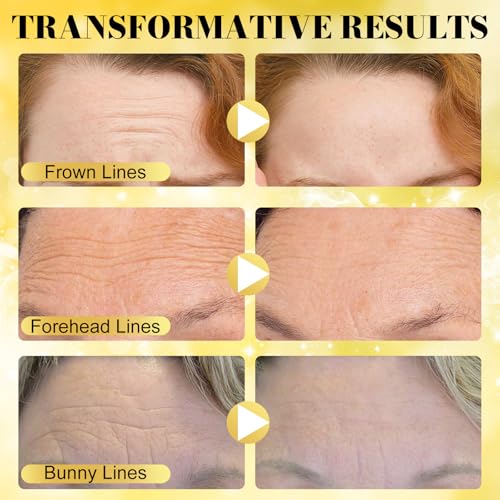 ReliCo Forehead Wrinkle Patches - 24K Gold Forehead Frown Wrinkles Pads with Collagen Boosting Elasticity for Women Men 16pcs