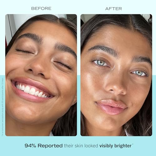 First Aid Beauty - Brighten + Glow Moisturizer with Vitamin C, Visibly Enhance Natural Healthy Glow for All Day Hydration, Lightweight Texture, Safe for Sensitive Skin, 1.7 oz