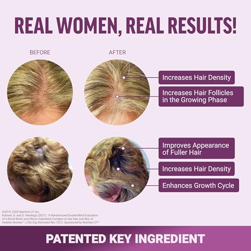 Force Factor Hair Growth Accelerator Soft Chews, Hair Growth Vitamins for Women with Clinically Proven Lustriva and Biotin to Promote Visibly Thicker, Fuller, Stronger Hair, Mixed Berry, 60 Soft Chews