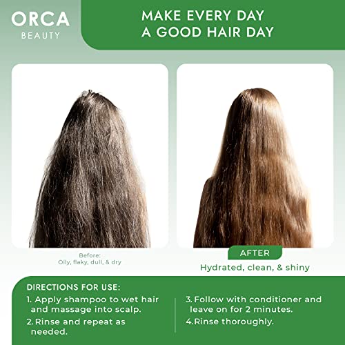 Orca Beauty Tea Tree Conditioner, 16oz - Hydrating and Invigorating Natural Conditioner for Men & Women with Oily Hair and Dry Scalp, Enriched with Vitamin E, Coconut Oil, Silk Proteins, and Rosemary