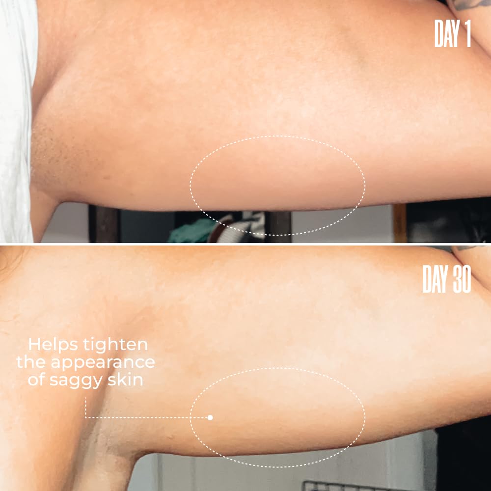 MAËLYS B-FLEX Lift & Firm Arm Cream - Firming Cream For Tighter and Firmer-Looking Arms - Helps Reduce The Appearance of Loose & Crepey Skin