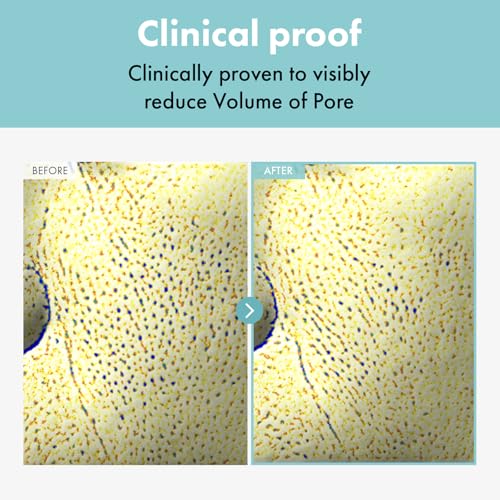 TOSOWOONG Pore Refiner Cream, Face Cream, Pore Extractor, Pore Minimize & Reducer and Remover. Best Pore Minimizer Treatment. Moisturizer for Oily Skin. K Beauty, Korean Skincare, 50g, 1.76 oz.