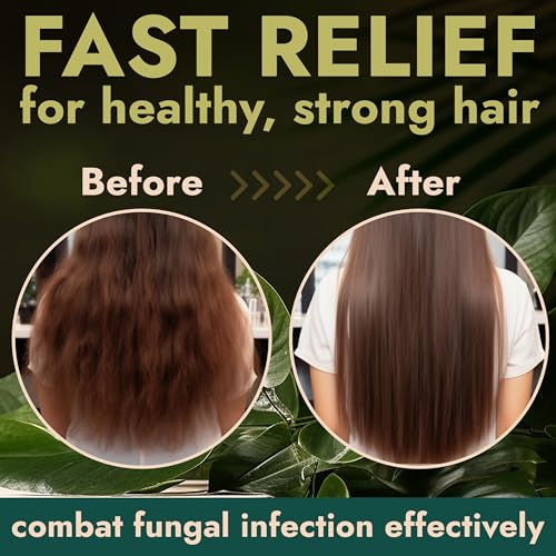 Tea Tree Shampoo & Conditioner Set | Thinning Hair Loss Treatments for Men and Women | Soothes Itchy Scalp & Dandruff | Boosts Hair Growth & Reduces Hair Loss | Sulfate & Paraben Free