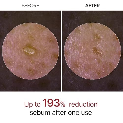 Dr.Melaxin Peel Shot Glow White Rice Peeling Ampoule, Soft Exfoliating Face and Body Scrub Dead Skin Cells Remover for All Skin Types korean skin care 80ml