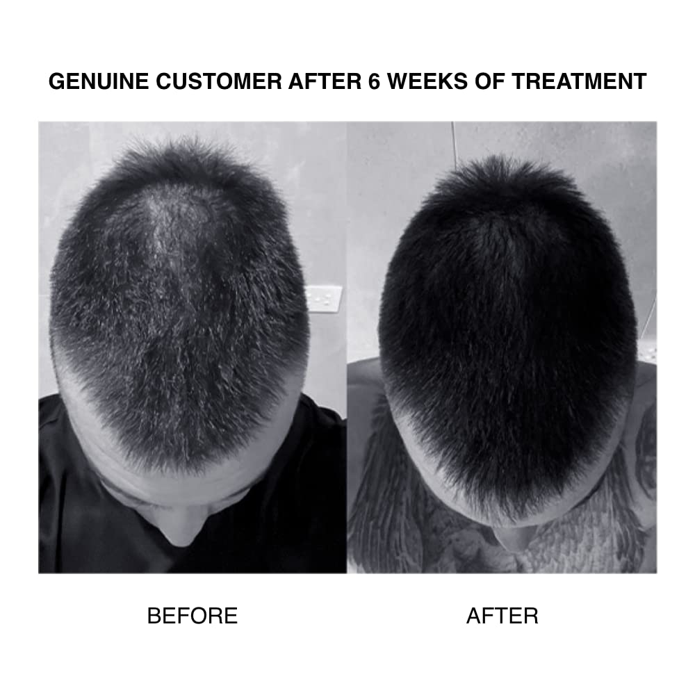 PATRICKS | CD PLUS Daily Conditioner | DHT Blocking Ultra Thickening Conditioner | Notes of Neroli, Bitter Orange | High Performance Grooming for Men | Thickens Hair & Stimulates Scalp | 200mL