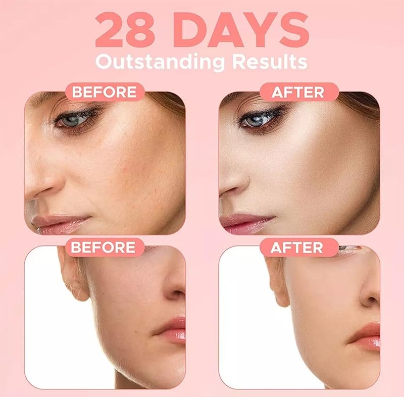 4 in 1 Facial Serum, 10% Hyaluronic Acid, 5% Niacinamide, 30% Vitamin C, 10% Vitamin E, 1.01 fl oz