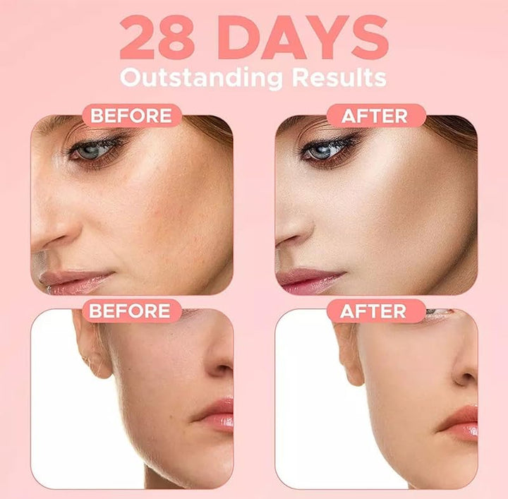 4 in 1 Facial Serum, 10% Hyaluronic Acid, 5% Niacinamide, 30% Vitamin C, 10% Vitamin E, 1.01 fl oz