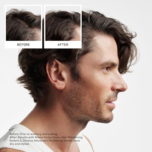 Nioxin Scalp + Hair Thickening System 2 Conditioner | For Natural or Untreated Hair with Progressed Thinning | With Niacinamide and Biotin | 16.9 Fl oz.