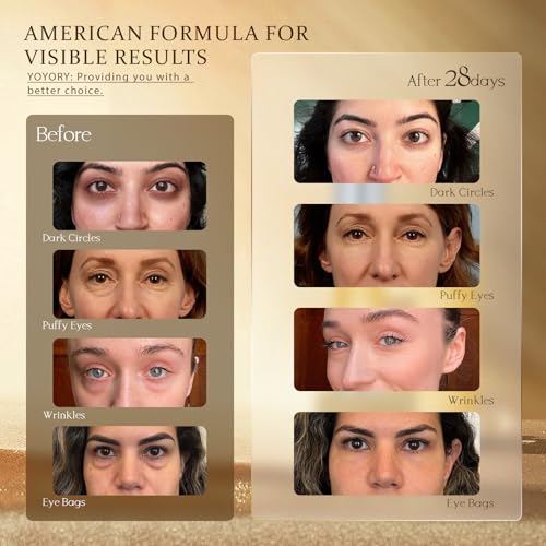 YOYORY Retinol Under Eye Cream - Eye Cream for Dark Circles and Puffiness, Eye Bags, Wrinkles Fine Lines Skin Care Treatment Hydrates & Lifts Gold(0.67 Fl Oz)